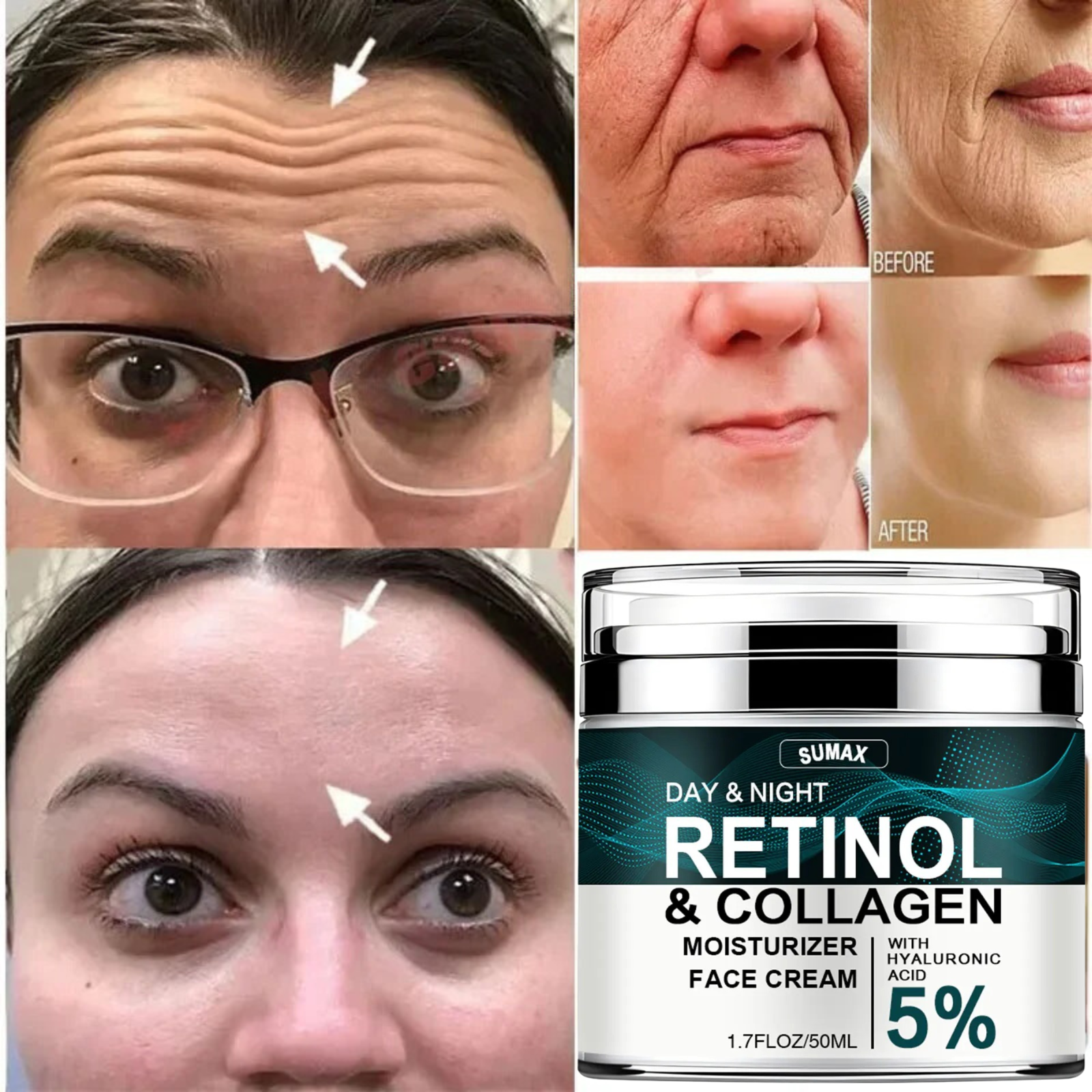 Anti-Aging Retinol & Collagen Cream