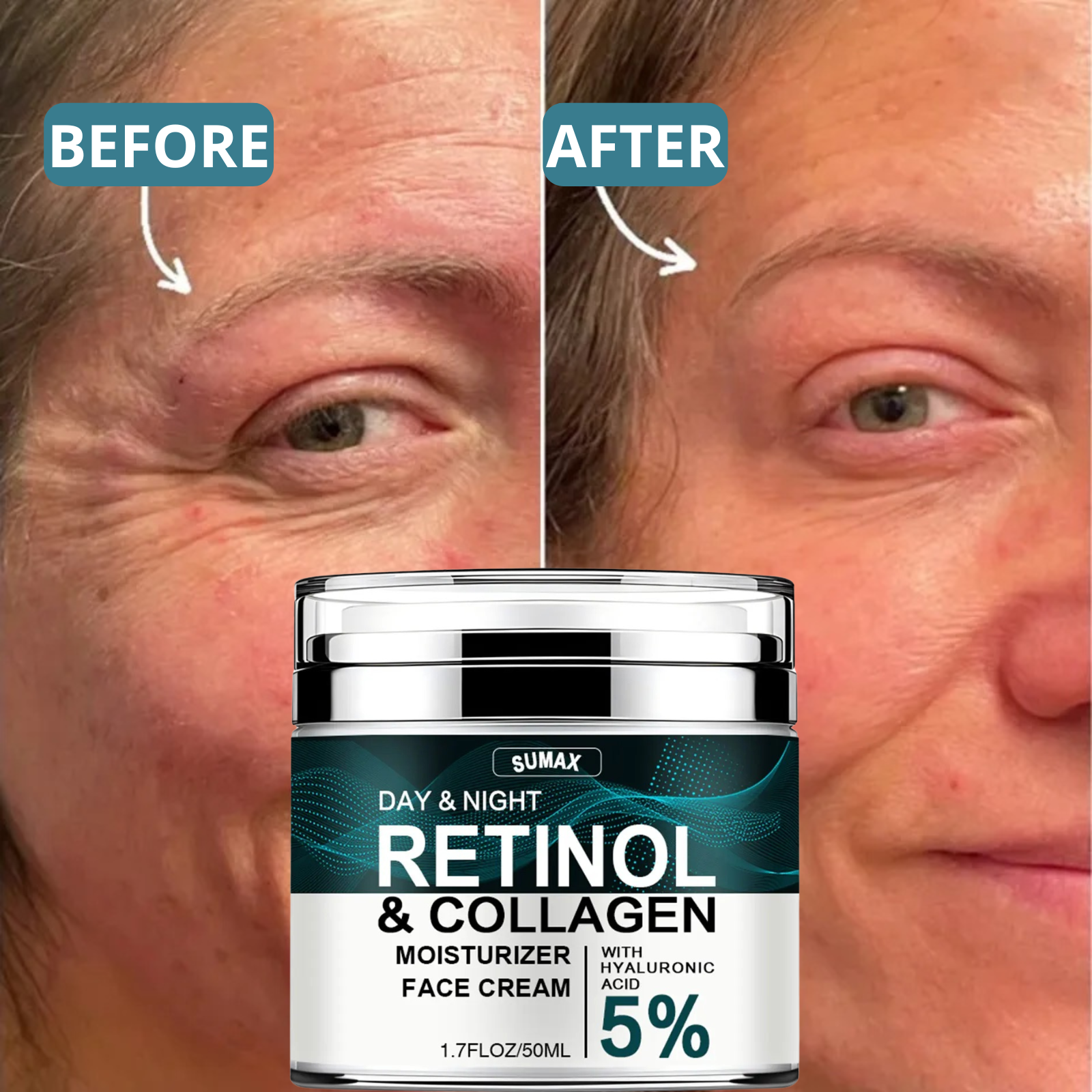 Anti-Aging Retinol & Collagen Cream