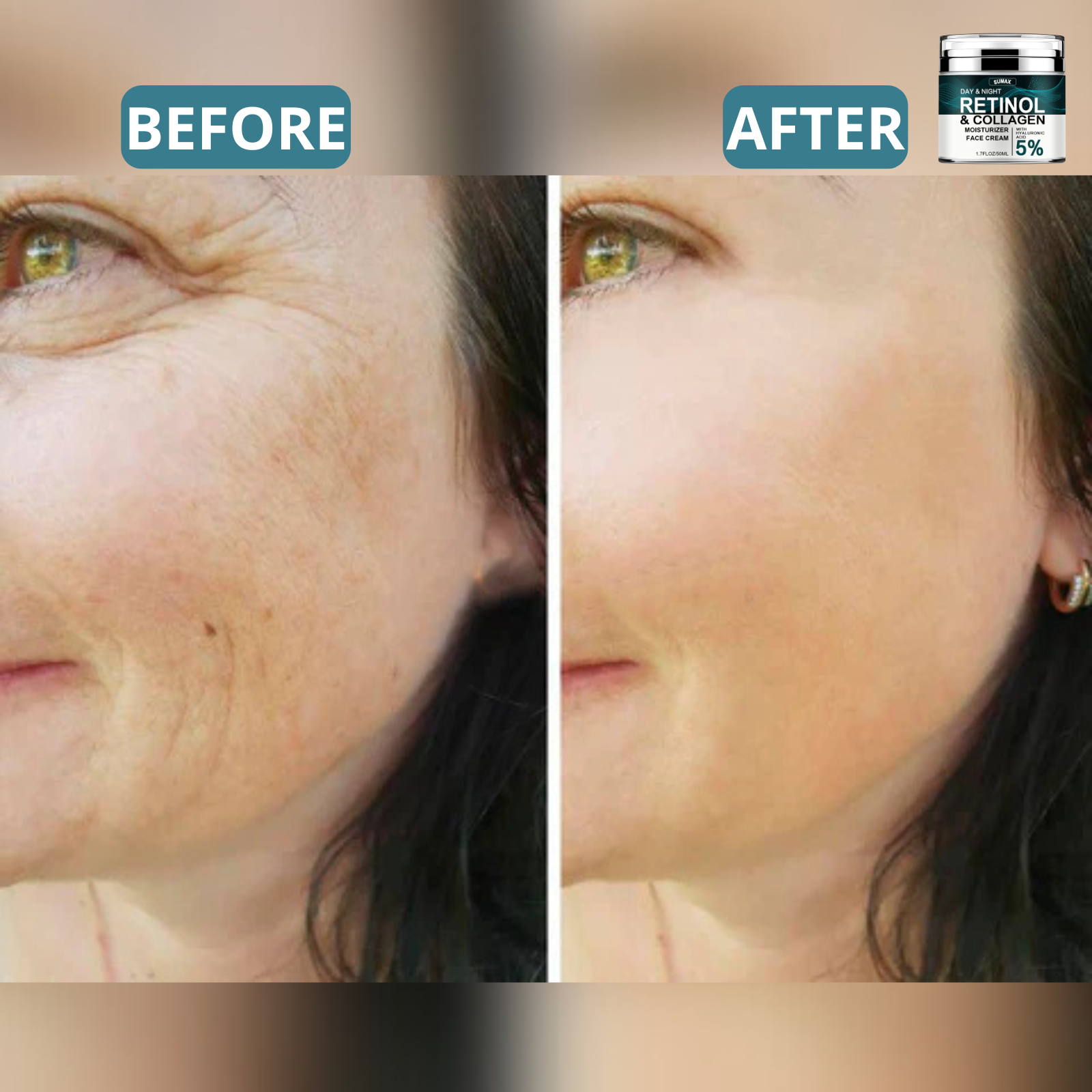 Anti-Aging Retinol & Collagen Cream